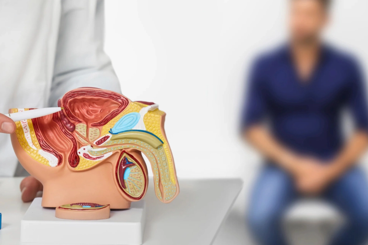Łagodny przerost prostaty – objawy, diagnostyka i leczenie